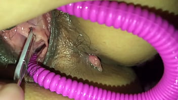 Entrada da uretra dolorida pos sexo